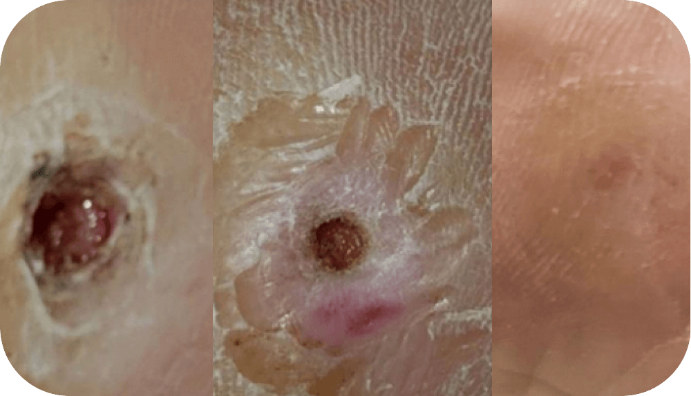 a close up of a skin with a large hole